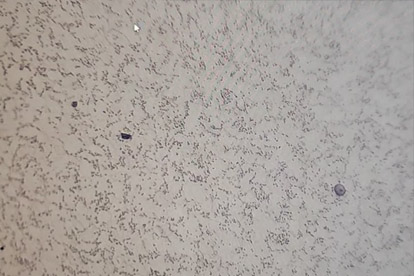 金相検出-500倍金相